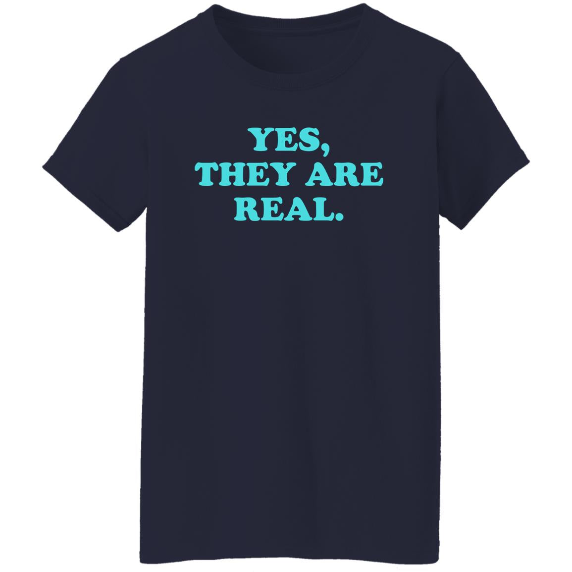 Yes They Are Real Shirt