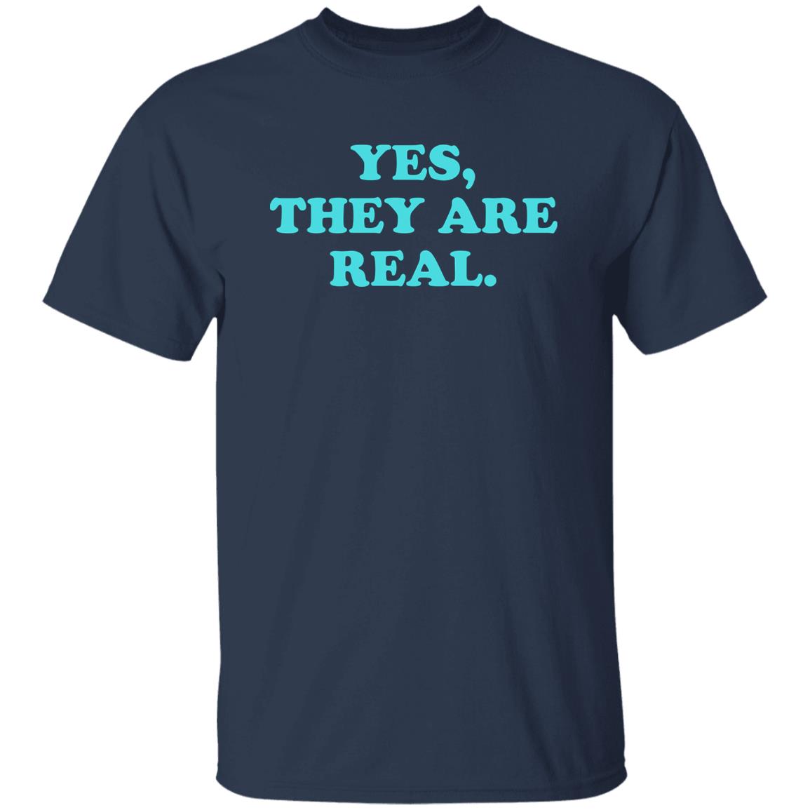 Yes They Are Real Shirt