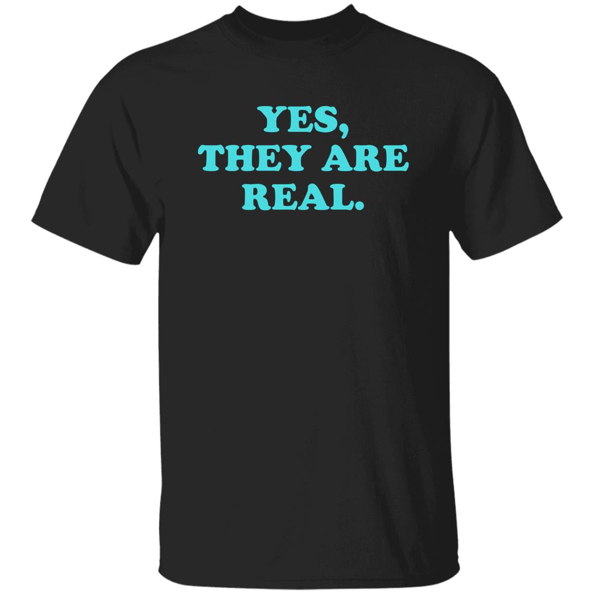 Yes They Are Real Shirt